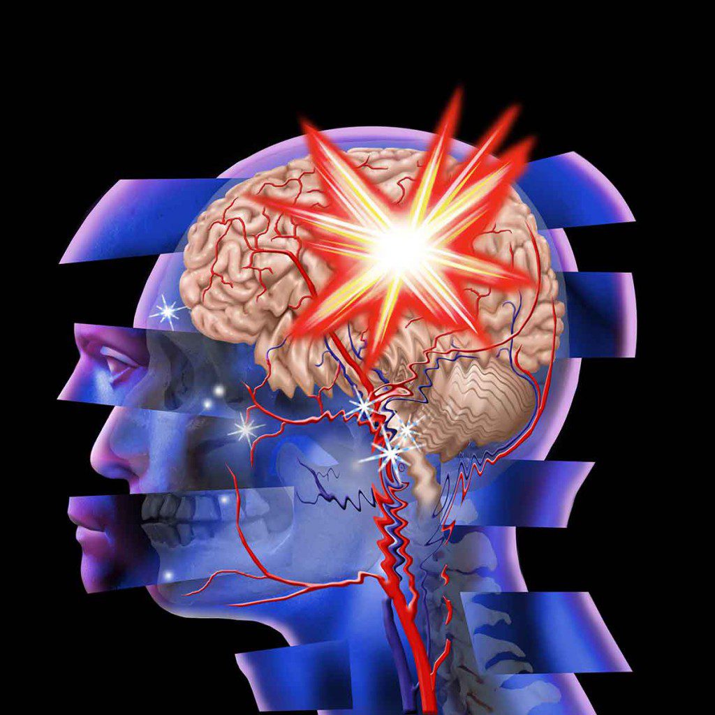 Traumatic Brain Injury And Domestic Violence Understanding The Gambaran