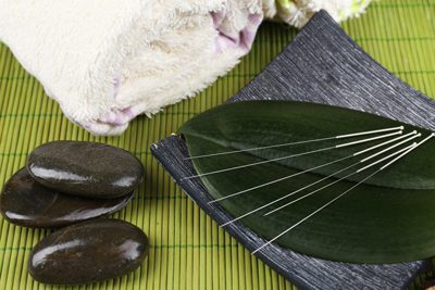 Acupuncture and Addiction Recovery - acupuncture - victory addiction recovery center